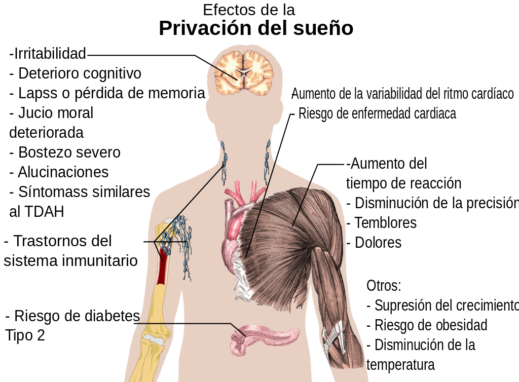 Efectos_de_la_privación_del_sueño